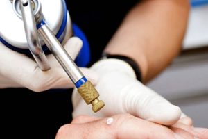 crioterapia a jesolo